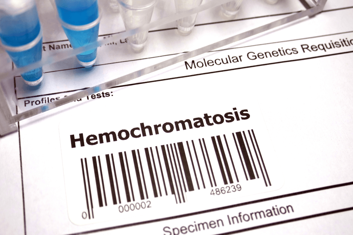 Hemochromatosis