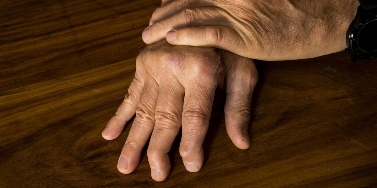 Osteoporosis and Diabetes